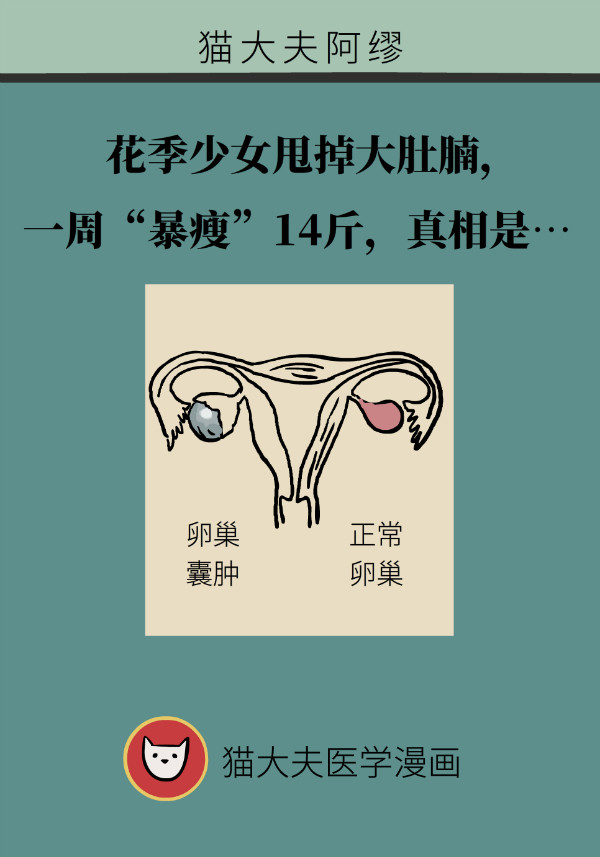 腰围莫名增粗别大意，你可能得了这种妇科疾病